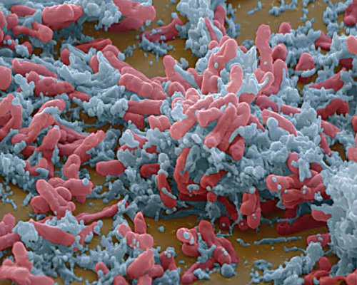 Mehr über den Artikel erfahren Bozen: „Gefahr vor Tuberkulose“ Infektionsrisiko sehr hoch