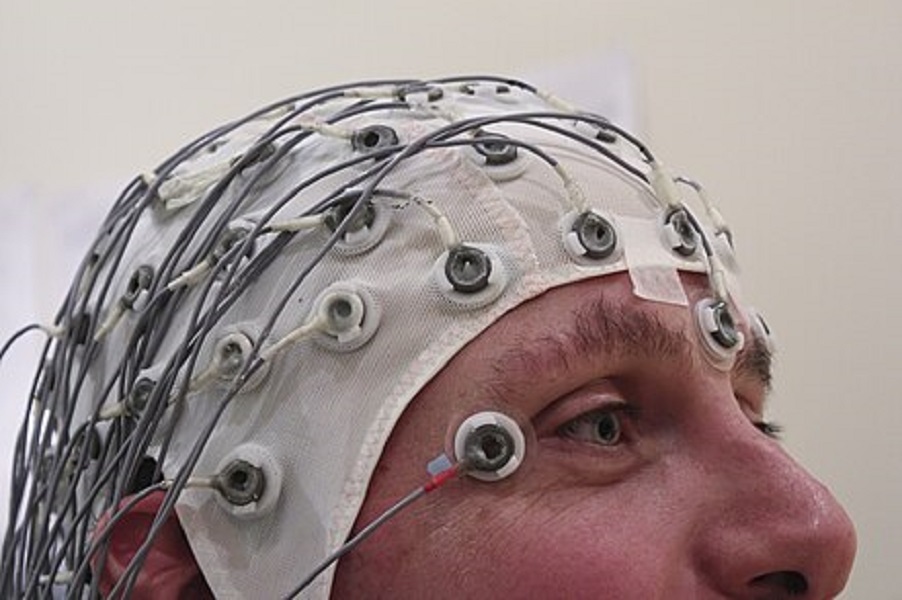 Scopri di più sull'articolo Epilepsiebehandlung: Erste erfolgreiche Implantation eines neuen Hirnschrittmachers in Österreich
