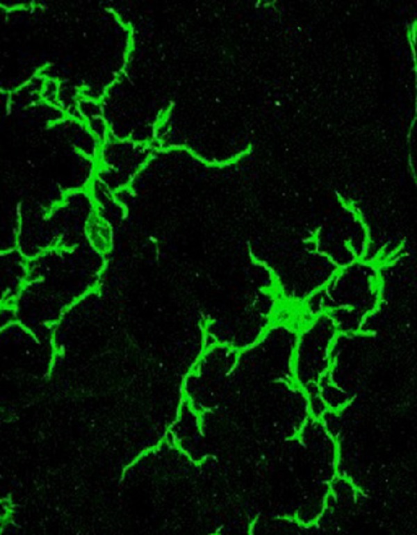 Mehr über den Artikel erfahren UniTrento – Autismo, la spia nell’infiammazione del cervelletto